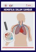 Hemofilia dalam Gambar (terjemahan dari Hemophilia in Pictures)